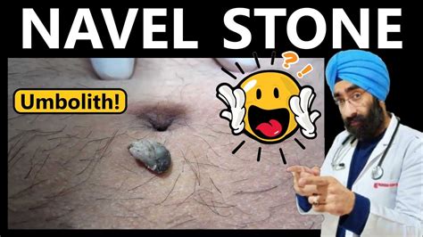 navel stone symptoms|Navel Stones: Understanding the Causes, Symptoms, and。